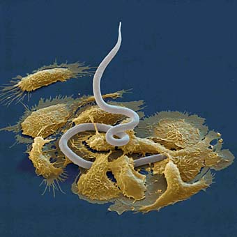 Das Bild zeigt Larven eines parasitischen Wurmes, die von Zellen des Wirtstieres angegriffen werden 