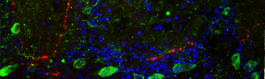 A glomerulus of the olfactory bulb surrounded by calbindin positive interneurons (green) and CGRP positive trigeminal fibers (red) - courtesy F. Genovese