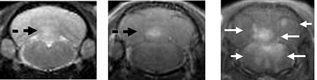Die Bilder zeigen das Gehirn während eines in Untersuchungen mit Tieren ausgelösten akuten MS-Krankheitsschubs: Während die entzündlichen Veränderungen auf den ersten beiden Bildern kaum oder nur schwach zu erkennen sind (gepunktete schwarze Pfeile), sind die Gewebeschädigungen im dritten Bild deutlich zu sehen (weiße Pfeile). Für dieses MRT-Bild wurde Versuchstieren zuvor ein neu entwickeltes Kontrast?mittel (Gadofluorine) verabreicht. Es kann im Vergleich zu herkömmlichen Kontrastmitteln deutlich mehr entzündliche Läsionen sichtbar machen.