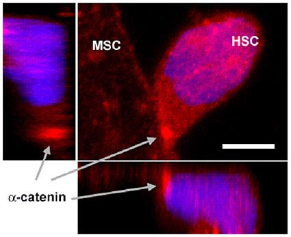 Das Bild zeigt sogenannte mesenchymale Stammzellen (MSC)