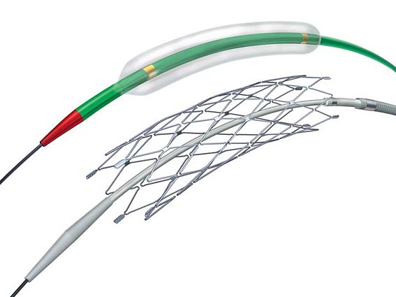 Das Wingspan Stent-System besteht aus zwei Komponenten: einem Plastikschlauch (Katheter, oben ), der an einem Ende einen Ballon trägt und einem Stent, eine winzige, maschenartige Metallröhre, die im Katheter liegt.