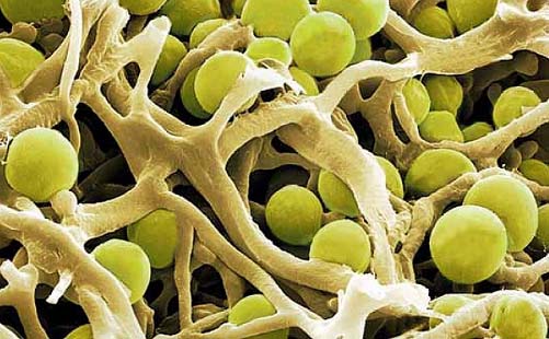 Mit bloßen Auge betrachtet völlig unscheinbar, beim Blick durch das Rasterelektronen-Mikroskop (REM) ein Kunstwerk: Bei der Flechtenart Xanthoria leben Algen und Pilz in Symbiose, die Algen wirken im REM wie kleine Kugeln zwischen den Pilzfäden.