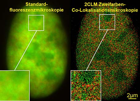 Blick in den Kern einer Knochenkrebszelle. Links: Bei der normalen Fluoreszenzmikroskopie sind Strukturdetails nicht erkennbar. Rechts: Mit der 2CLM Zweifarben-Co-Lokalisationsmikroskopie lassen sich Zigtausende (120.000) von Molekülen klar unterscheiden.