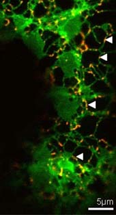 Teil einer Epidermiszelle aus einem Tabakblatt: Das Netzwerk des Endoplasmatischen Retikulums ist durch ein spezielles Markerprotein grün visualisiert. Die Importstellen sind mit einem speziellen rot fluoreszierenden Protein gefärbt.